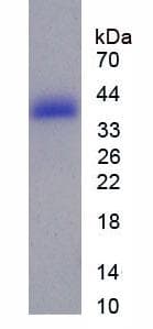 Human MAPT / Tau Protein (Recombinant 6His, N-terminus)