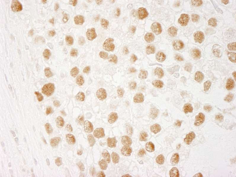 CHTF18 / RUVBL Antibody (aa25-75)