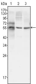 Monoclonal Mouse anti-Human TUBB3 / Tubulin Beta 3 Antibody (clone 2E9, IF, WB)