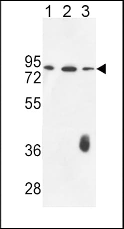 F12 / Factor XII Antibody (aa7-34)