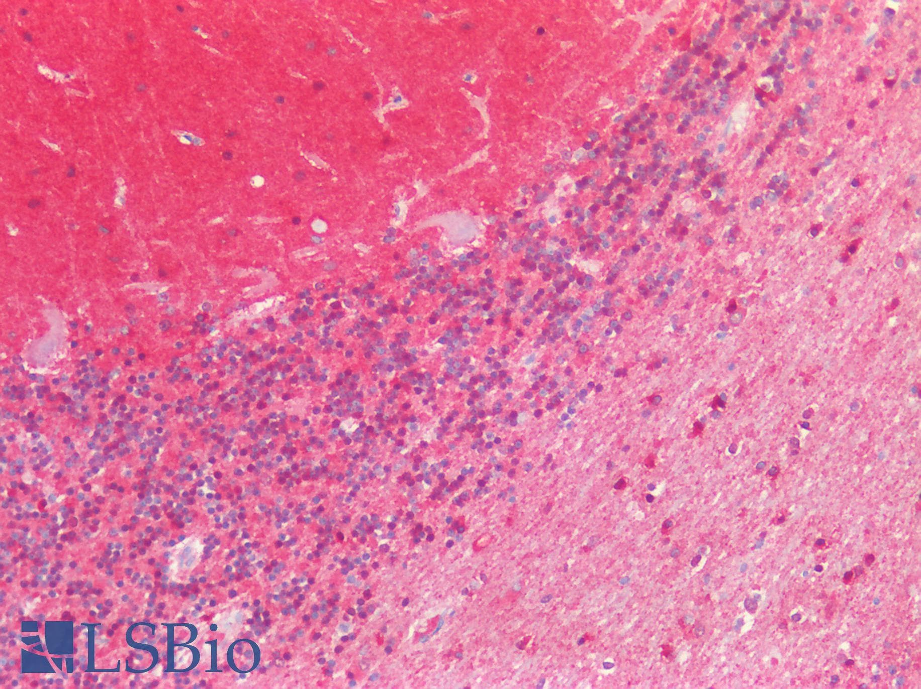 PathPlus™ MAPT / Tau Antibody (aa463-512)
