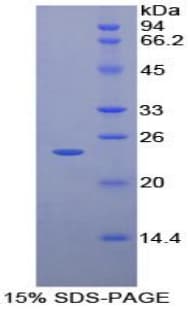 Human TIMP2 Protein (Recombinant His)