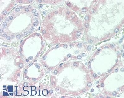 IHC-plus™ Polyclonal Rabbit anti-Human DIXDC1 Antibody (aa225-275, IHC)