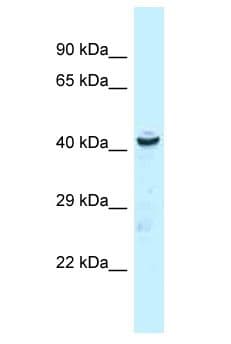 UBR7 / C14orf130 Antibody (aa83-132)