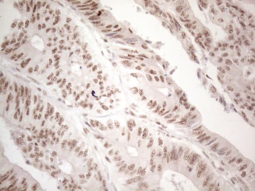 WTAP Antibody (aa2-106, clone OTI6H3)