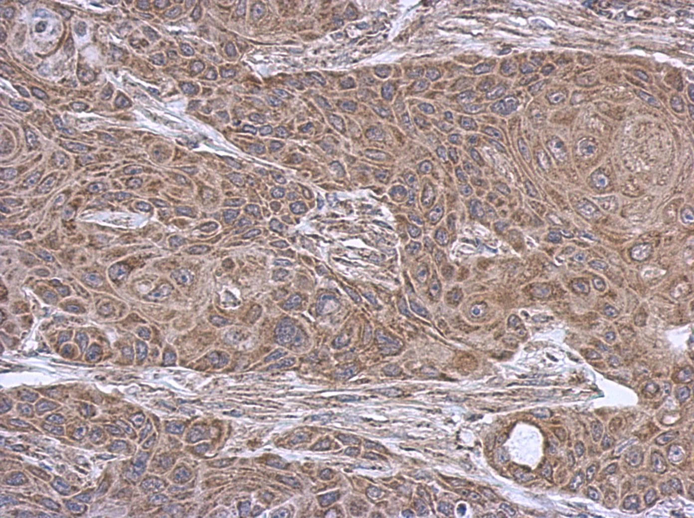 Polyclonal Rabbit anti-Human SUCLA2 Antibody (aa138-416, IHC, WB)