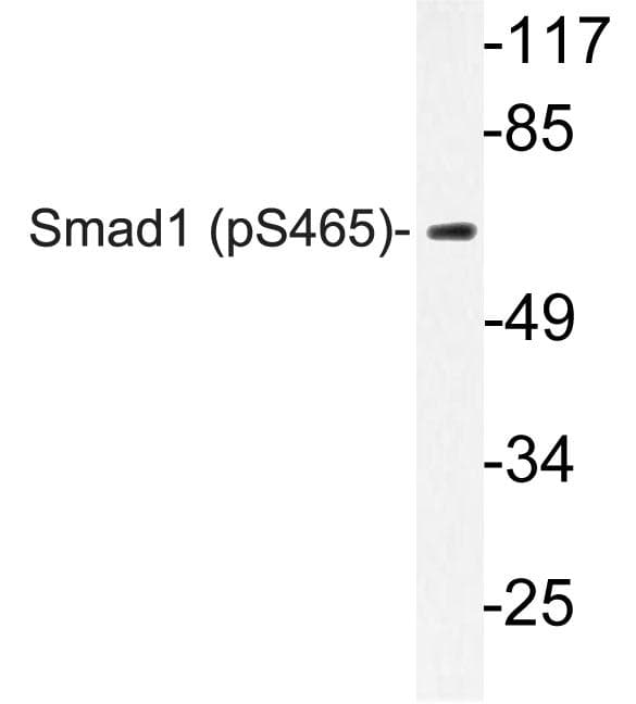 SMAD1 Antibody (phospho-Ser465)
