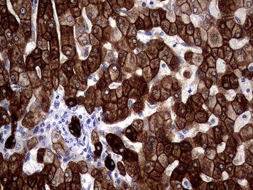 Monoclonal Mouse anti-Human KRT18 / CK18 / Cytokeratin 18 Antibody (clone OTI10H8, Carrier-free, aa69-372, IHC, WB)