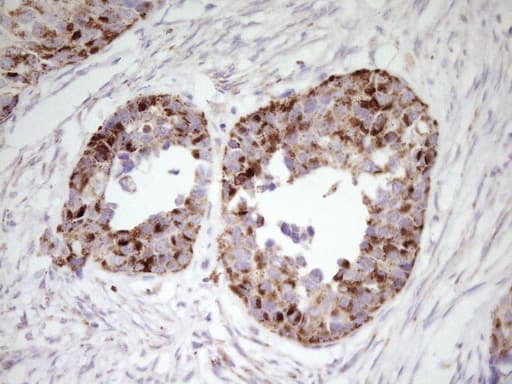 Monoclonal Mouse anti-Human ABAT Antibody (clone UMAB178, aa29-323, IHC, IF, WB)
