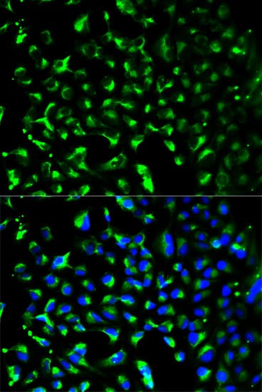 PHB / Prohibitin Antibody