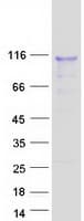 Human DMP1 Protein (Recombinant Myc-DDK (Flag))