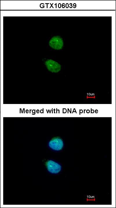ZKSCAN3 / ZNF306 Antibody (aa1-394)
