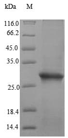 Human FR4 / Folate Receptor 4 Protein (Recombinant 6His, N-terminus)
