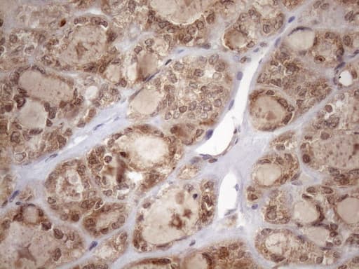 TDG / Thymine DNA Glycosylase Antibody (aa160-253, clone OTI3A12)