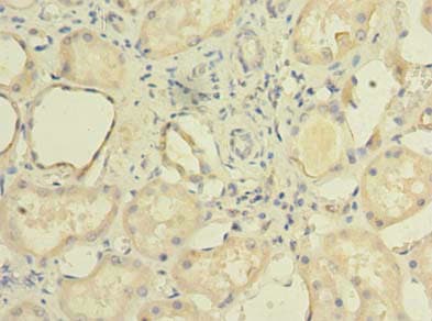 TCTE1 Antibody