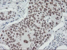 SENP2 Antibody (aa139-523, clone OTI3D3, Carrier-free)