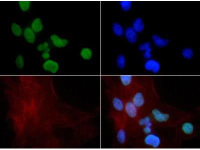 HIST3H3 Antibody (Me-Lys9)