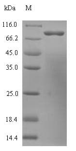 Human HDC / Histidine Decarboxylase Protein (Recombinant 6His, N-terminus)