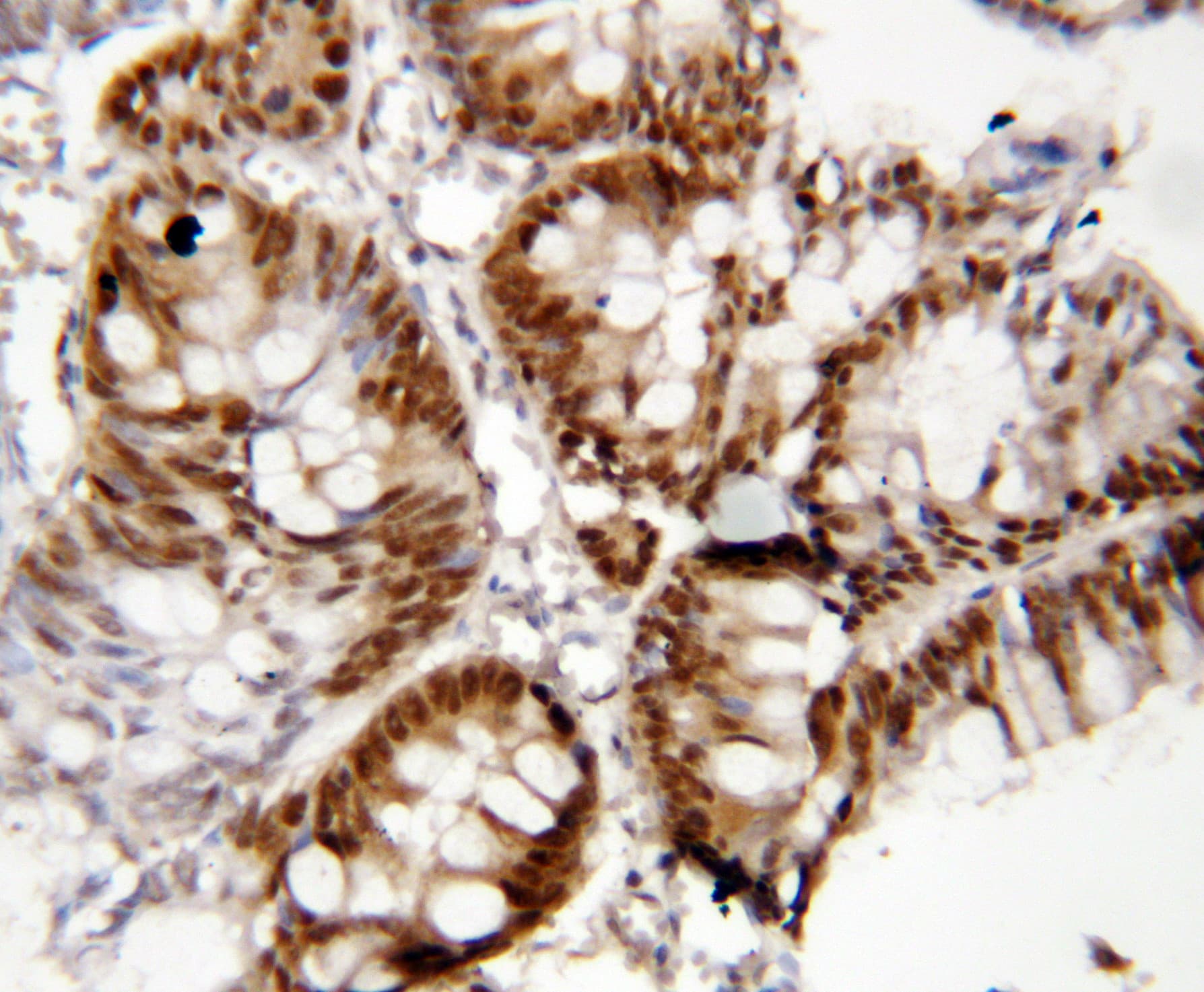 FOXP1 Antibody (aa657-677)