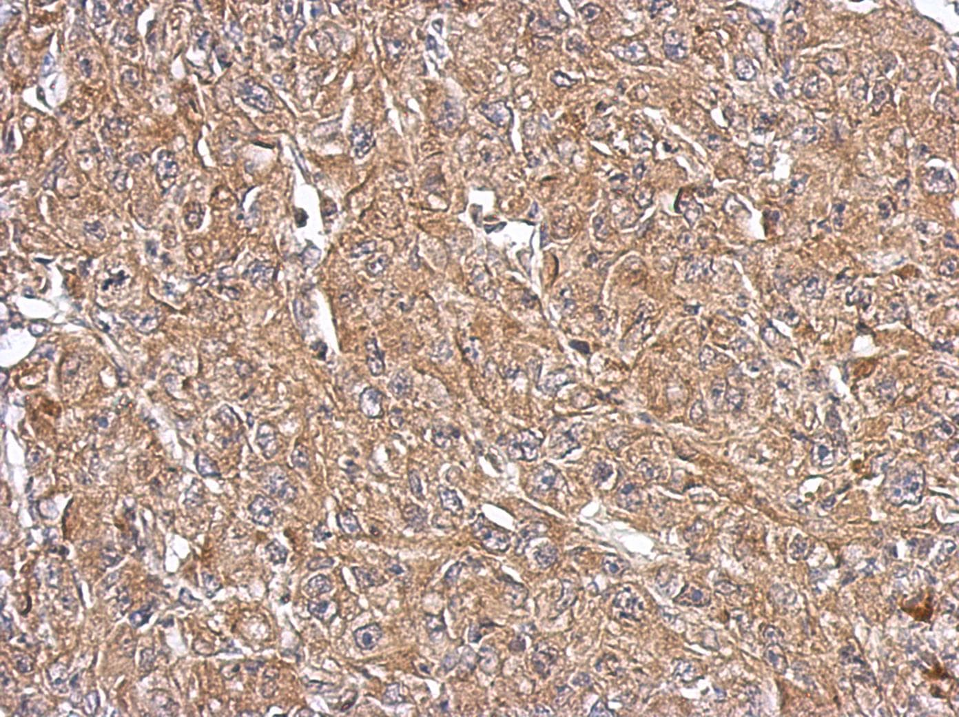 Polyclonal Rabbit anti-Human OXSM / KS Antibody (IHC, WB)