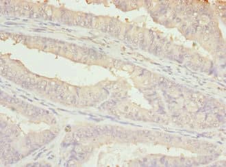 BBS2 / BBS Antibody