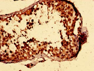 ISLET-1 / ISL1 Antibody