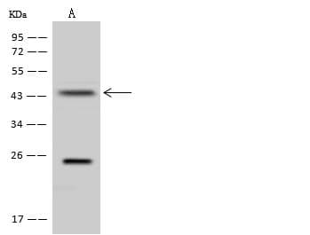 Polyclonal Rabbit anti-Human QTRT1 Antibody (WB)