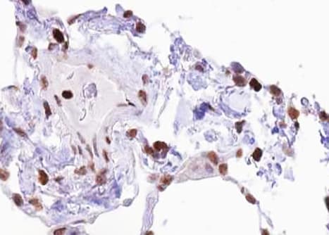 ELK1 Antibody (phospho-Ser383)