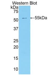 SMPD2 Antibody (aa2-236, Cy3)