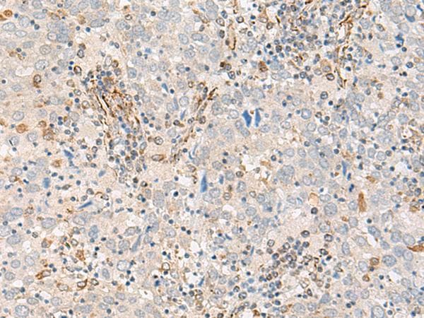 FECH / Ferrochelatase Antibody
