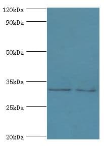 Polyclonal Rabbit anti-Human RDM1 Antibody (aa125-284, IHC, WB)