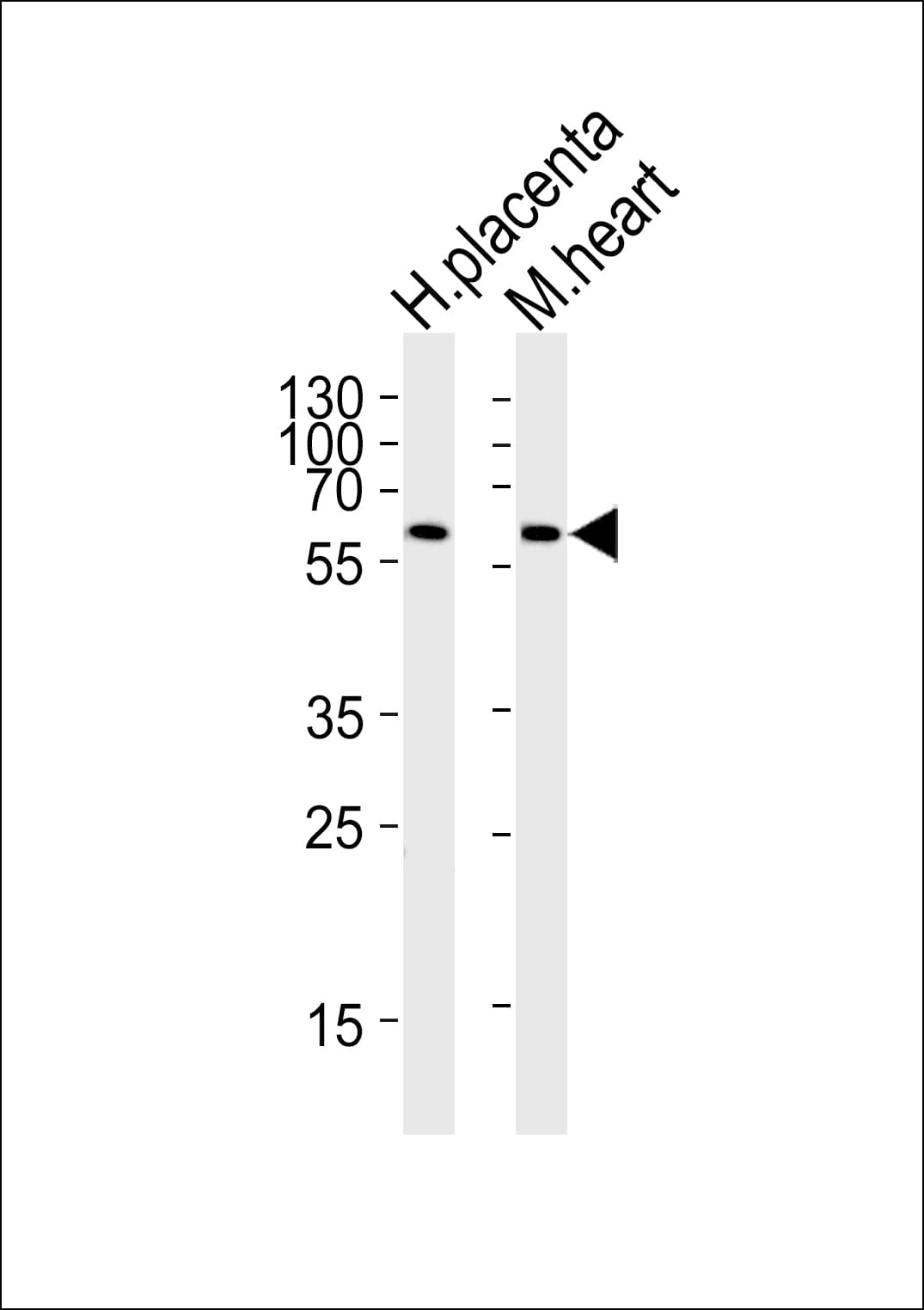 PPARG / PPAR Gamma Antibody (aa2-35)