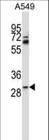 TATDN1 Antibody (aa115-143)