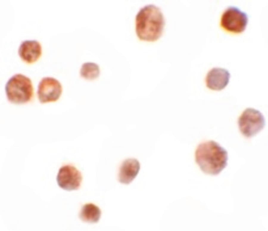 TYW2 / TRMT12 Antibody
