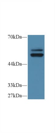 PTPN5 / STEP Antibody