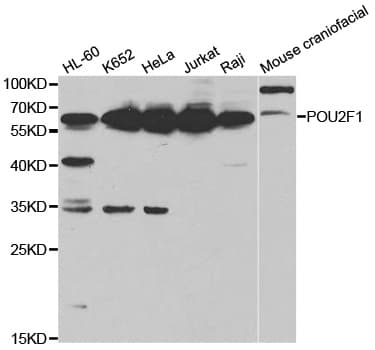 Polyclonal Rabbit anti-Human POU2F1 / OCT1 Antibody (IHC, WB)