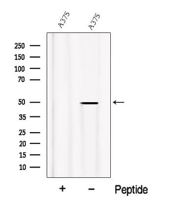 Polyclonal Rabbit anti-Human PDSS2 / DLP1 Antibody (WB)