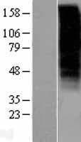 GnRH receptor / GNRHR Protein (Over-Expression Lysate Myc-DDK (Flag))