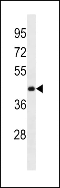 Polyclonal Rabbit anti-Human ANKRD63 Antibody (aa229-255, WB)