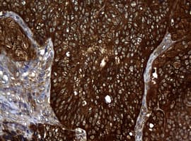 NME1 / NM23 Antibody (clone OTI1A12)