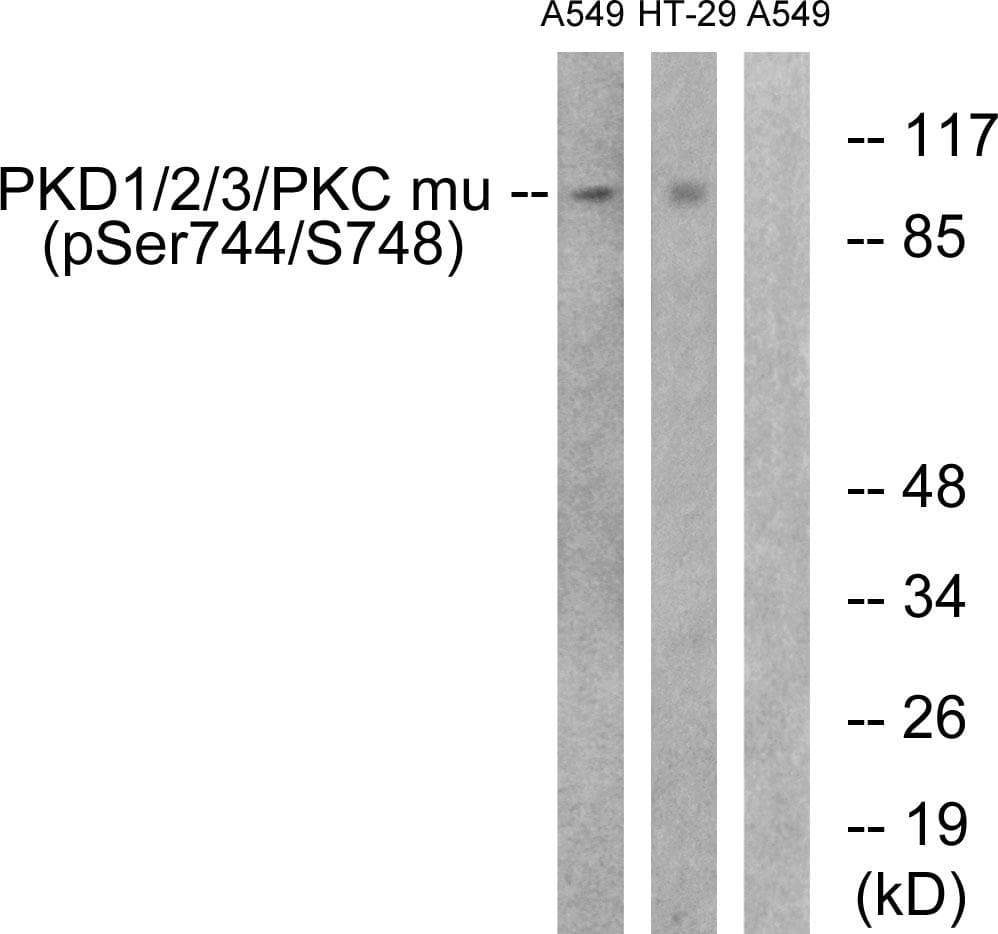 PRKD1 / PKC Mu Antibody (phospho-Ser738+Ser742)