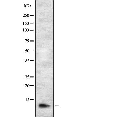 Polyclonal Rabbit anti-Human DIRC1 Antibody (IHC, WB)