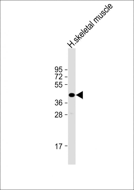 TMEM115 Antibody (aa249-283)
