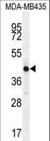 ALX4 Antibody (aa249-275)