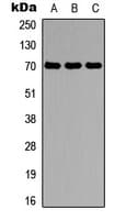 PPP2R5D Antibody (C-Terminus)