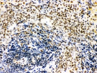 CTBP1 / CTBP Antibody