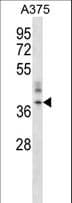 TMEM142A / ORAI1 Antibody (aa269-298)