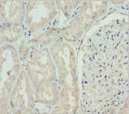 Polyclonal Rabbit anti-Human GNS Antibody (IHC, WB)