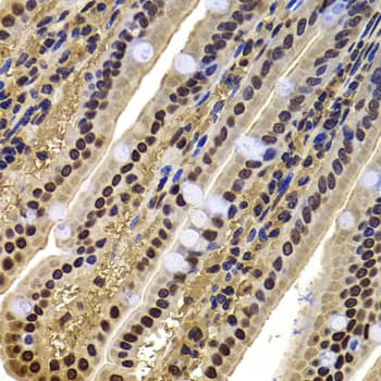 Polyclonal Rabbit anti-Human BAF53B / ACTL6B Antibody (IHC, IF, WB)