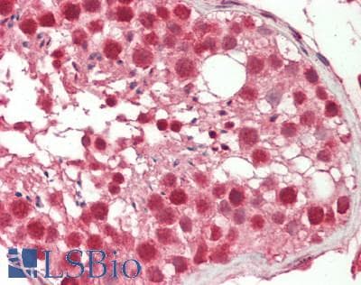 IHC-plus™ CPSF3 / CPSF Antibody (aa1-50)